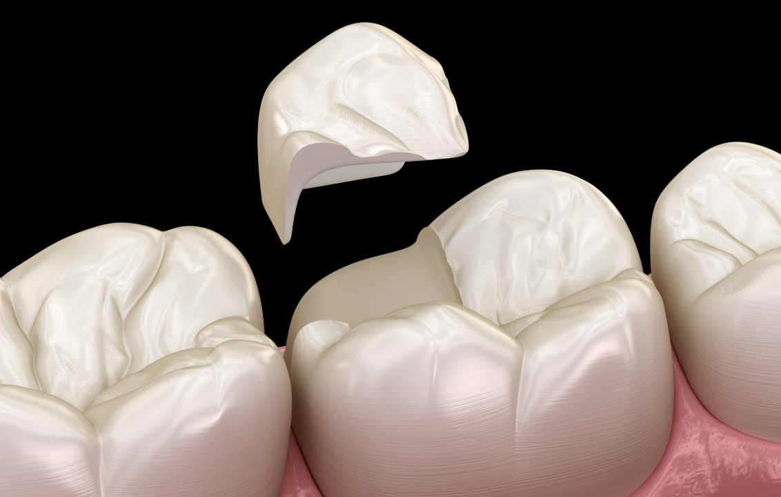 審美治療
